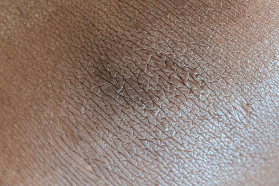A maquiagem "some" ou fica com aspecto de casca em algumas áreas