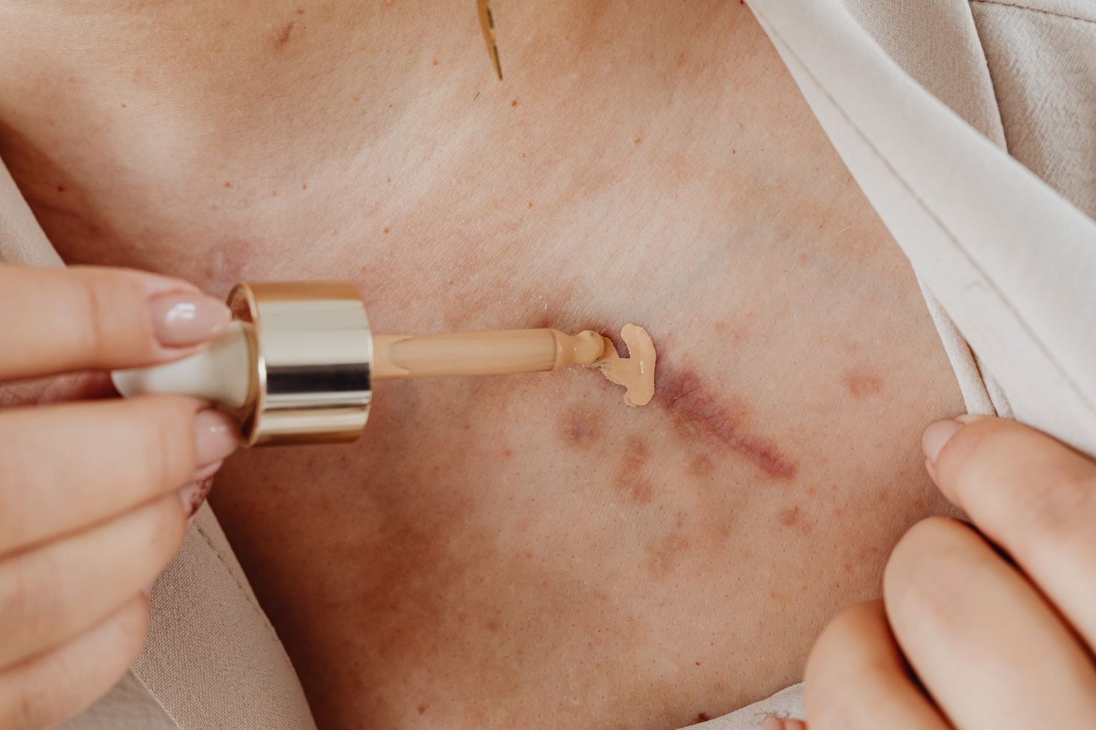A técnica que iguala o tom da pele de verdade! Aprenda a maquiagem para vitiligo passo a passo!